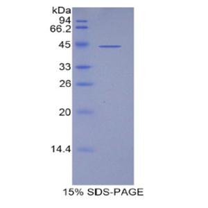 脂质运载蛋白15(LCN15)重组蛋白,Recombinant Lipocalin 15 (LCN15)