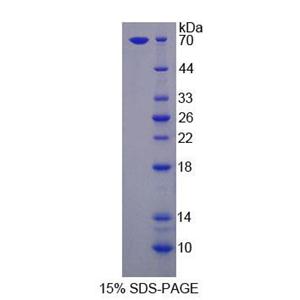 脂解激活脂蛋白受体(LSR)重组蛋白