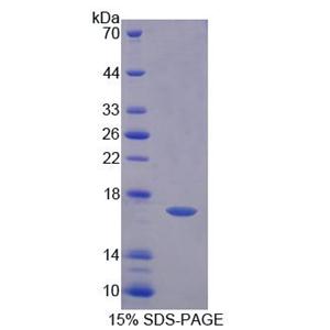 脂肪酸去饱和酶3(FADS3)重组蛋白,Recombinant Fatty Acid Desaturase 3 (FADS3)