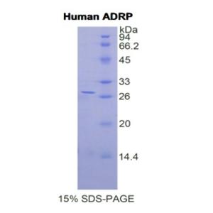 脂肪分化相关蛋白(ADRP)重组蛋白