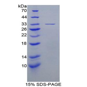 真核翻译起始因子3A(EIF3A)重组蛋白,Recombinant Eukaryotic Translation Initiation Factor 3A (EIF3A)