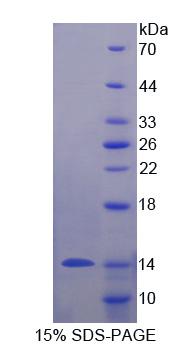 粘蛋白3B(MUC3B)重组蛋白,Recombinant Mucin 3B, Cell Surface Associated (MUC3B)