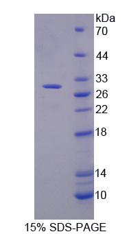 粘蛋白17(MUC17)重组蛋白,Recombinant Mucin 17 (MUC17)