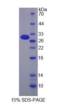 粘蛋白13(MUC13)重组蛋白,Recombinant Mucin 13, Cell Surface Associated (MUC13)