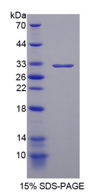 早幼粒细胞白血病蛋白(PML)重组蛋白,Recombinant Promyelocytic Leukemia Protein (PML)