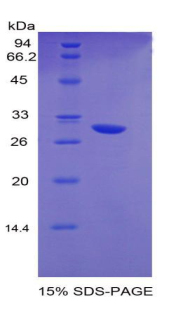 早期生长应答因子2(EGR2)重组蛋白,Recombinant Early Growth Response Protein 2 (EGR2)