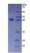 载脂蛋白M(APOM)重组蛋白,Recombinant Apolipoprotein M (APOM)