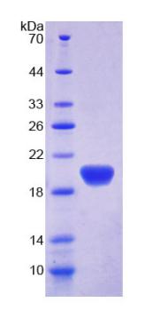 載脂蛋白L2(APOL2)重組蛋白,Recombinant Apolipoprotein L2 (APOL2)