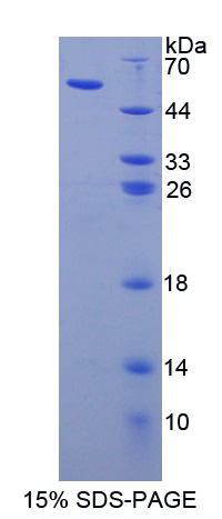 載脂蛋白L1(APOL1)重組蛋白,Recombinant Apolipoprotein L (APOL1)