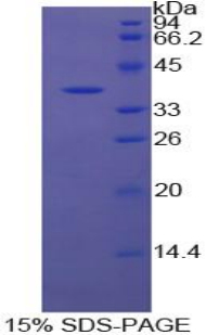 载脂蛋白H(APOH)重组蛋白,Recombinant Apolipoprotein H (APOH)