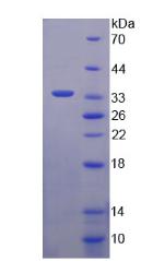 載脂蛋白C3(APOC3)重組蛋白,Recombinant Apolipoprotein C3 (APOC3)