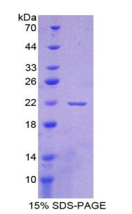 载脂蛋白A1结合蛋白(APOA1BP)重组蛋白,Recombinant Apolipoprotein A1 Binding Protein (APOA1BP)