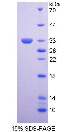 運動神經(jīng)元生存蛋白2(SMN2)重組蛋白,Recombinant Survival Of Motor Neuron 2, Centromeric (SMN2)