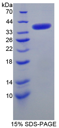 運動神經(jīng)元生存蛋白1(SMN1)重組蛋白,Recombinant Survival Motor Neuron Protein (SMN)