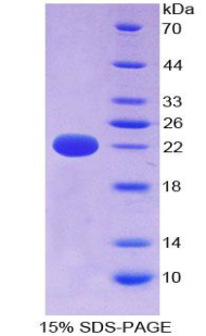 圆柱瘤蛋白(CYLD)重组蛋白,Recombinant Cylindromatosis (CYLD)