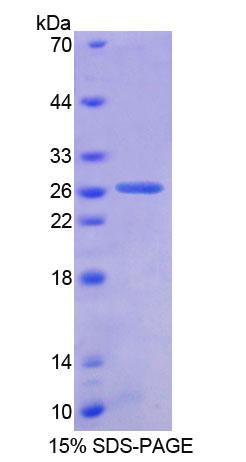 原始广泛存在蛋白1(AUP1)重组蛋白,Recombinant Ancient Ubiquitous Protein 1 (AUP1)