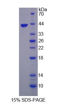 原肌球调节蛋白3(TMOD3)重组蛋白,Recombinant Tropomodulin 3 (TMOD3)