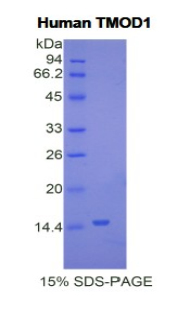 原肌球調(diào)節(jié)蛋白1(TMOD1)重組蛋白,Recombinant Tropomodulin 1 (TMOD1)