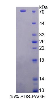 原卟啉原氧化酶(PPOX)重组蛋白,Recombinant Protoporphyrinogen Oxidase (PPOX)