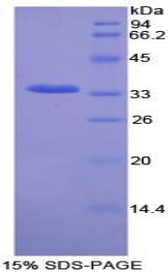 永离有丝分裂基因A相关激酶2(NEK2)重组蛋白,Recombinant Never In Mitosis Gene A Related Kinase 2 (NEK2)