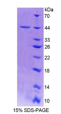 抑絲蛋白3(PFN3)重組蛋白,Recombinant Profilin 3 (PFN3)