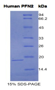 抑丝蛋白2(PFN2)重组蛋白,Recombinant Profilin 2 (PFN2)