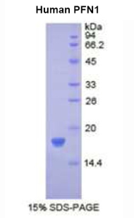 抑丝蛋白1(PFN1)重组蛋白,Recombinant Profilin 1 (PFN1)