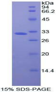 抑瘤素M受体(OSMR)重组蛋白,Recombinant Oncostatin M Receptor (OSMR)