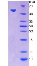 抑瘤素M(OSM)重組蛋白,Recombinant Oncostatin M (OSM)