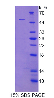 异柠檬酸脱氢酶2(IDH2)重组蛋白,Recombinant Isocitrate Dehydrogenase 2, mitochondrial (IDH2)