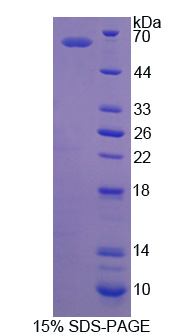 异亮氨酰tRNA合成酶(IARS)重组蛋白,Recombinant Isoleucyl tRNA Synthetase (IARS)