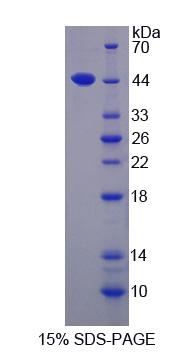 乙酰辅酶A乙酰转移酶1(ACAT1)重组蛋白,Recombinant Acetyl Coenzyme A Acetyltransferase 1 (ACAT1)