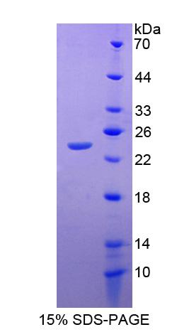 乙酰胆碱酯酶关联蛋白(ACHAP)重组蛋白,Recombinant Acetylcholinesterase Associated Protein (ACHAP)