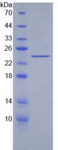 乙酰胆碱酯酶(AchE)重组蛋白,Recombinant Acetylcholinesterase (ACHE)