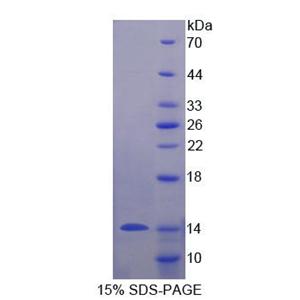 粘蛋白3B(MUC3B)重组蛋白,Recombinant Mucin 3B, Cell Surface Associated (MUC3B)