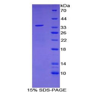 早期生長應(yīng)答因子3(EGR3)重組蛋白,Recombinant Early Growth Response Protein 3 (EGR3)