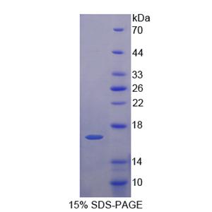 早期内体抗原1(EEA1)重组蛋白,Recombinant Early Endosome Antigen 1 (EEA1)