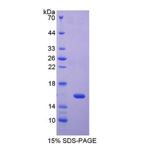 再生胰岛衍生蛋白4(REG4)重组蛋白