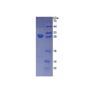 载脂蛋白M(APOM)重组蛋白,Recombinant Apolipoprotein M (APOM)