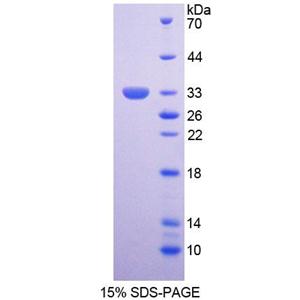 运动神经元生存蛋白2(SMN2)重组蛋白