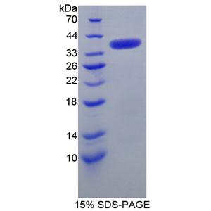 运动神经元生存蛋白1(SMN1)重组蛋白