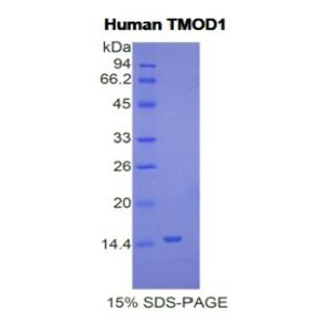 原肌球调节蛋白1(TMOD1)重组蛋白