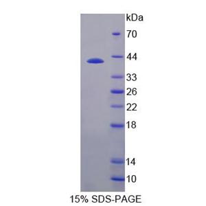 原肌球蛋白3(TPM3)重组蛋白,Recombinant Tropomyosin 3 (TPM3)