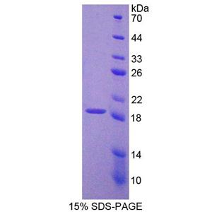 原钙黏素20(PCDH20)重组蛋白,Recombinant Protocadherin 20 (PCDH20)
