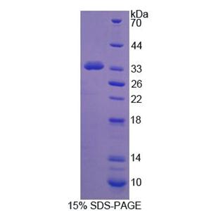 原钙黏素15(PCDH15)重组蛋白