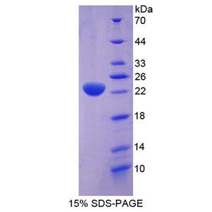 应激诱导磷蛋白1(STIP1)重组蛋白,Recombinant Stress Induced Phosphoprotein 1 (STIP1)