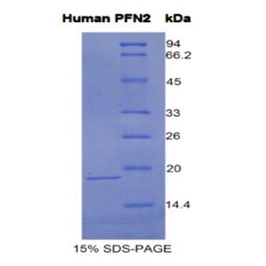 抑丝蛋白2(PFN2)重组蛋白