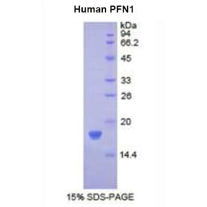 抑丝蛋白1(PFN1)重组蛋白