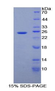 乙醇脱氢酶1(ADH1)重组蛋白,Recombinant Alcohol Dehydrogenase 1 (ADH1)