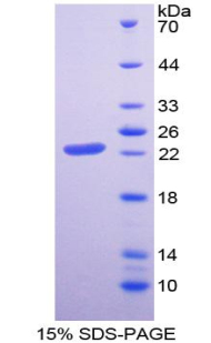 胰脂肪酶(PL)重组蛋白,Recombinant Pancreatic Lipase (PL)